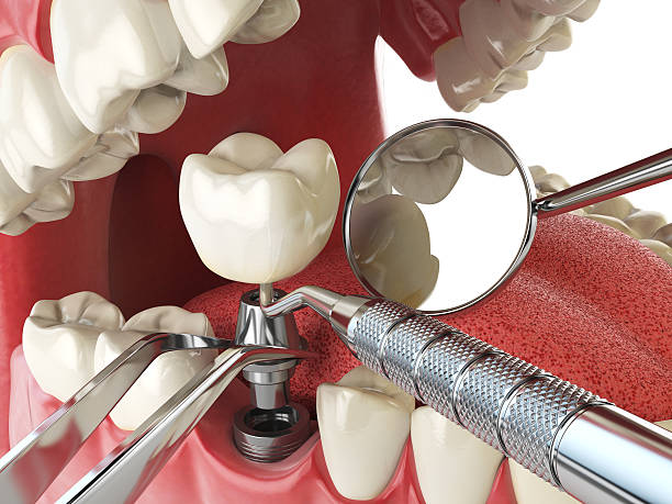 Best Emergency Dental Care for Trauma or Injury in Second Mesa, AZ